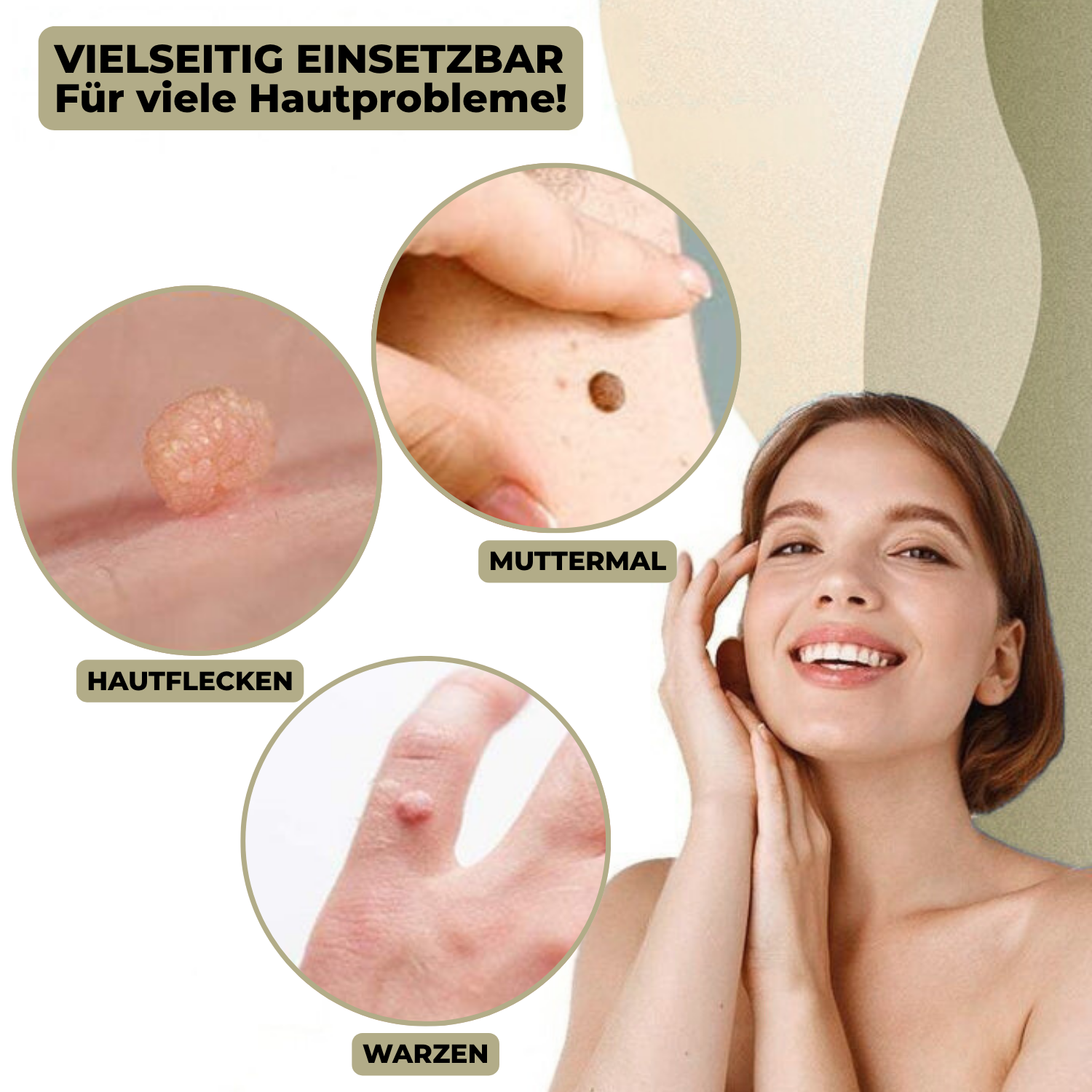 DermaLinx Warzenentferner – Bild 2 von 9