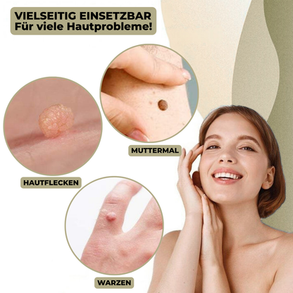 DermaLinx Warzenentferner – Bild 2 von 9