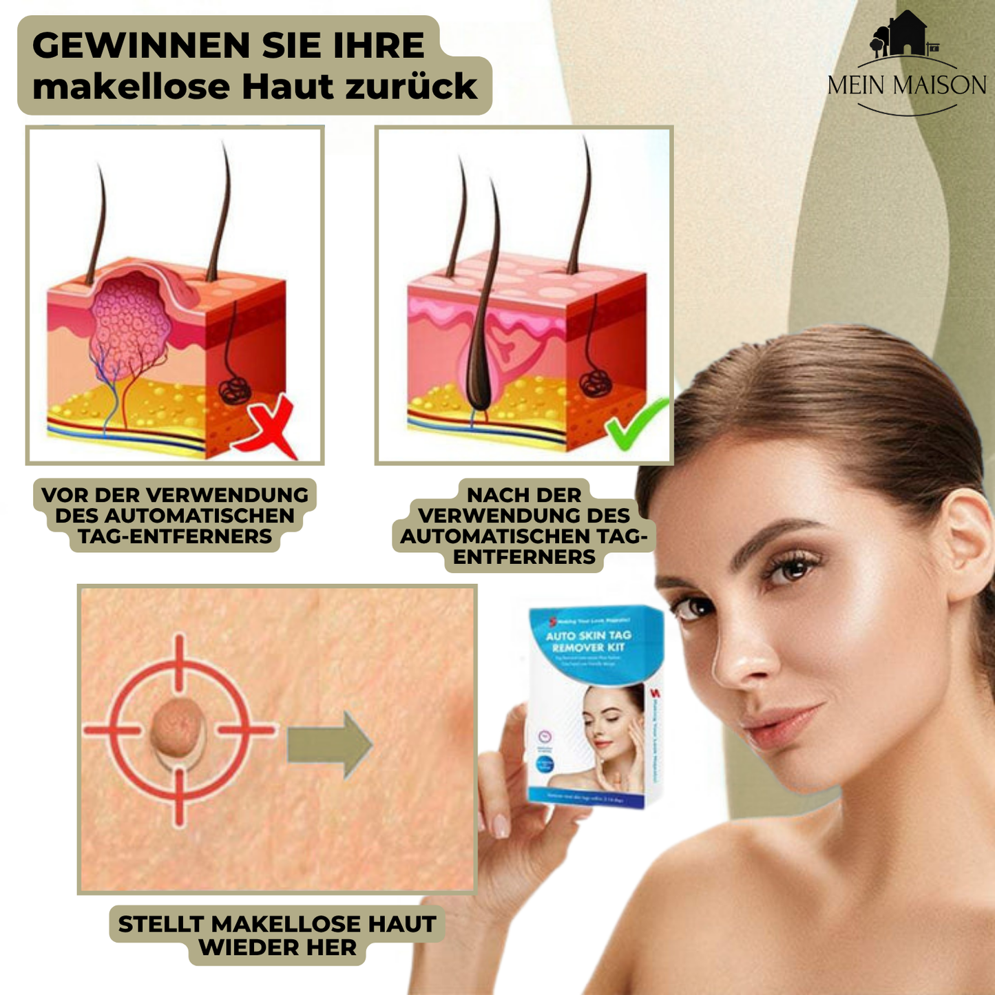 DermaLinx Warzenentferner – Bild 5 von 9