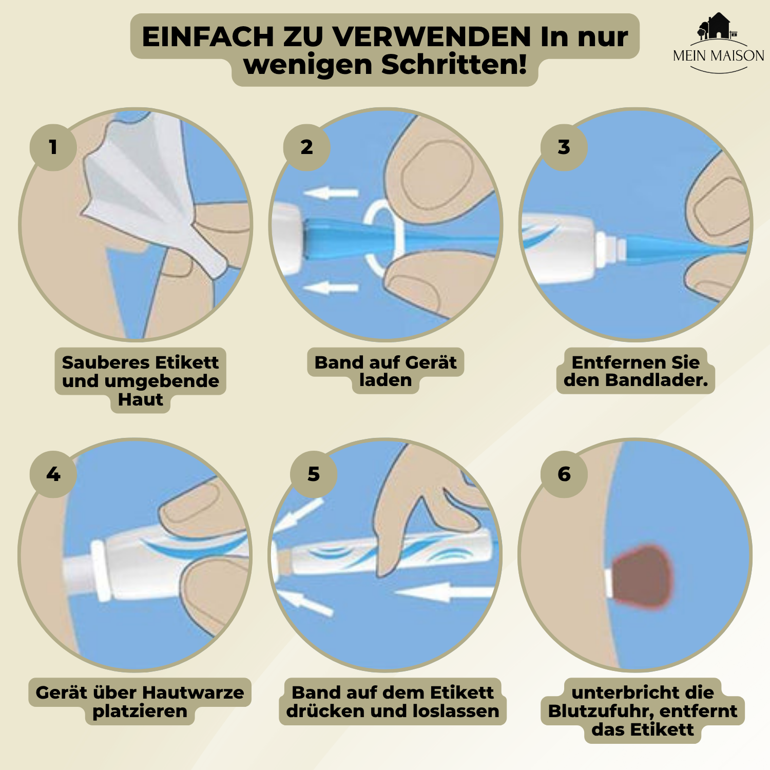 DermaLinx Warzenentferner – Bild 7 von 9