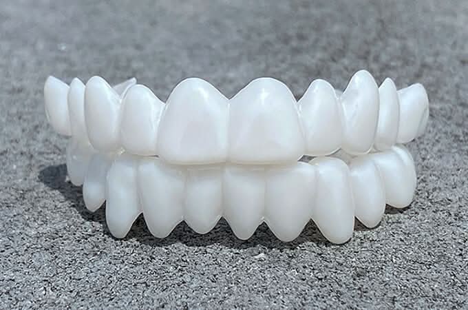 SmileFlex - Anpassbare Zahnprothese mit Dental-Linsen – Bild 4 von 5