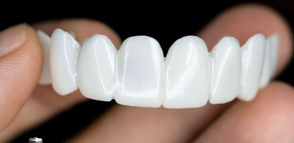 SmileFlex - Anpassbare Zahnprothese mit Dental-Linsen – Bild 2 von 5