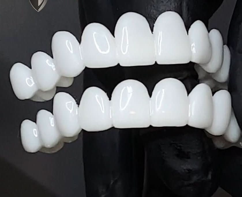 SmileFlex - Anpassbare Zahnprothese mit Dental-Linsen – Gesundheit & Wellness