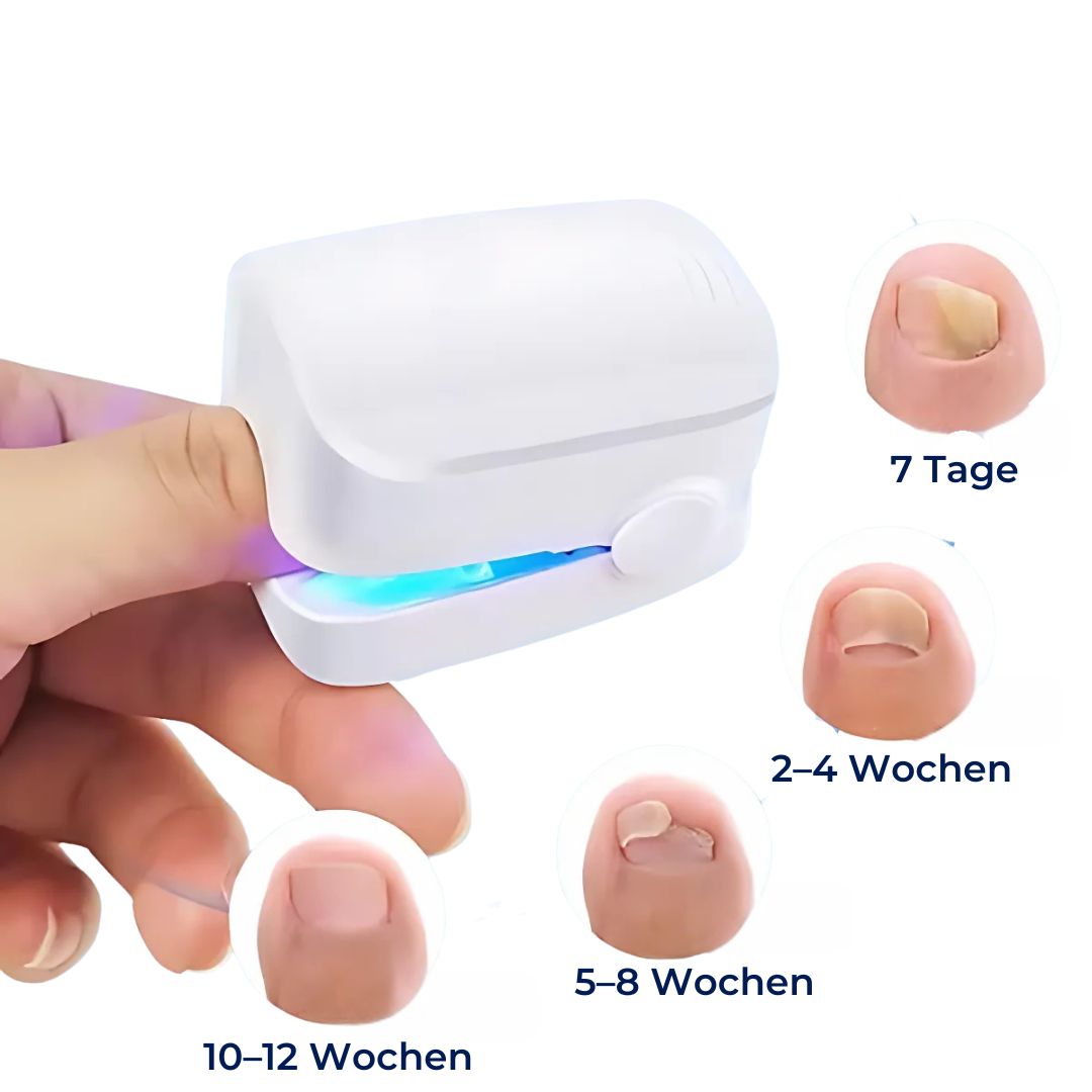 ClearNagel Pro – Bild 5 von 6