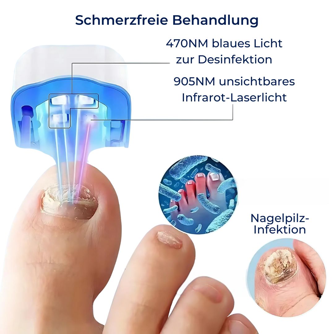 ClearNagel Pro – Bild 6 von 6