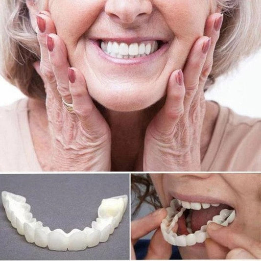 On Smile Veneers (Ober- und Unterkiefer inbegriffen)