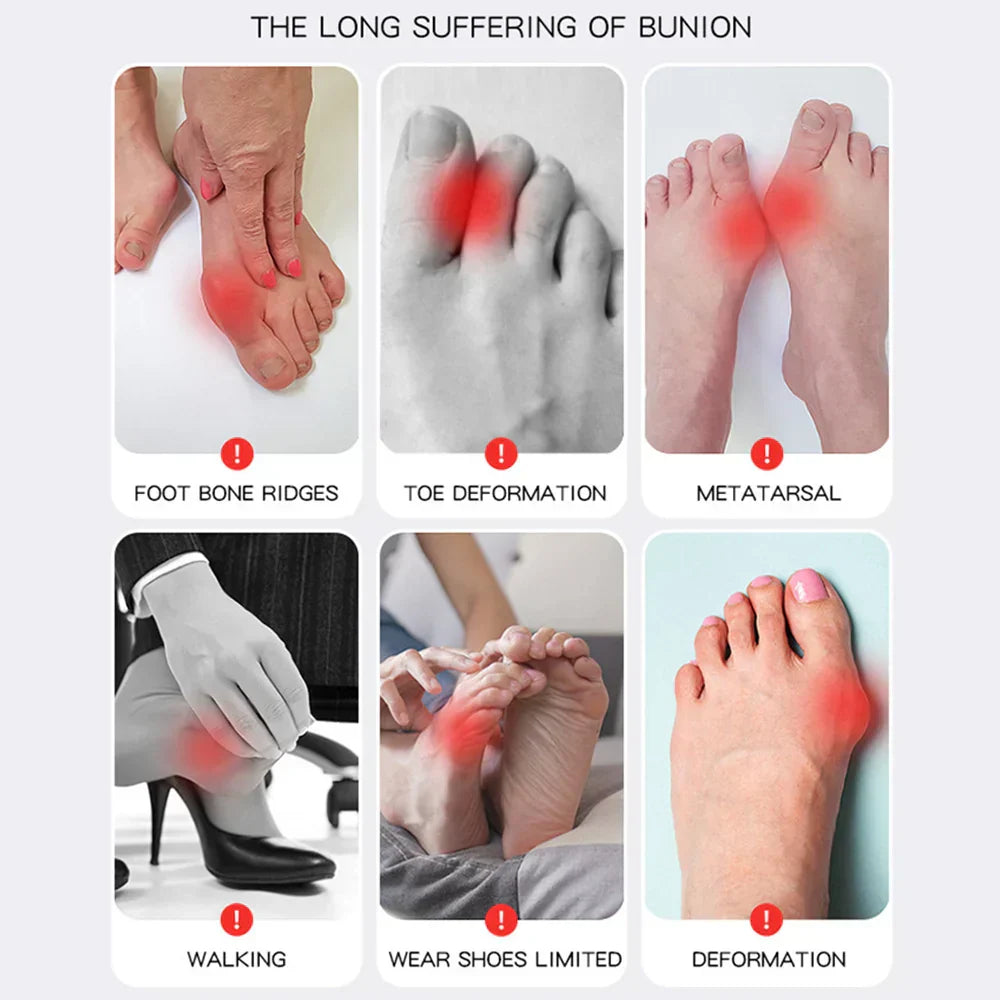 Hallux Valgus Bandage – Pelanva – Ansicht 5