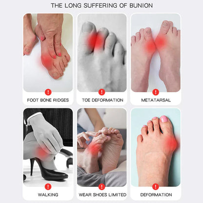 Hallux Valgus Bandage – Pelanva – Ansicht 5
