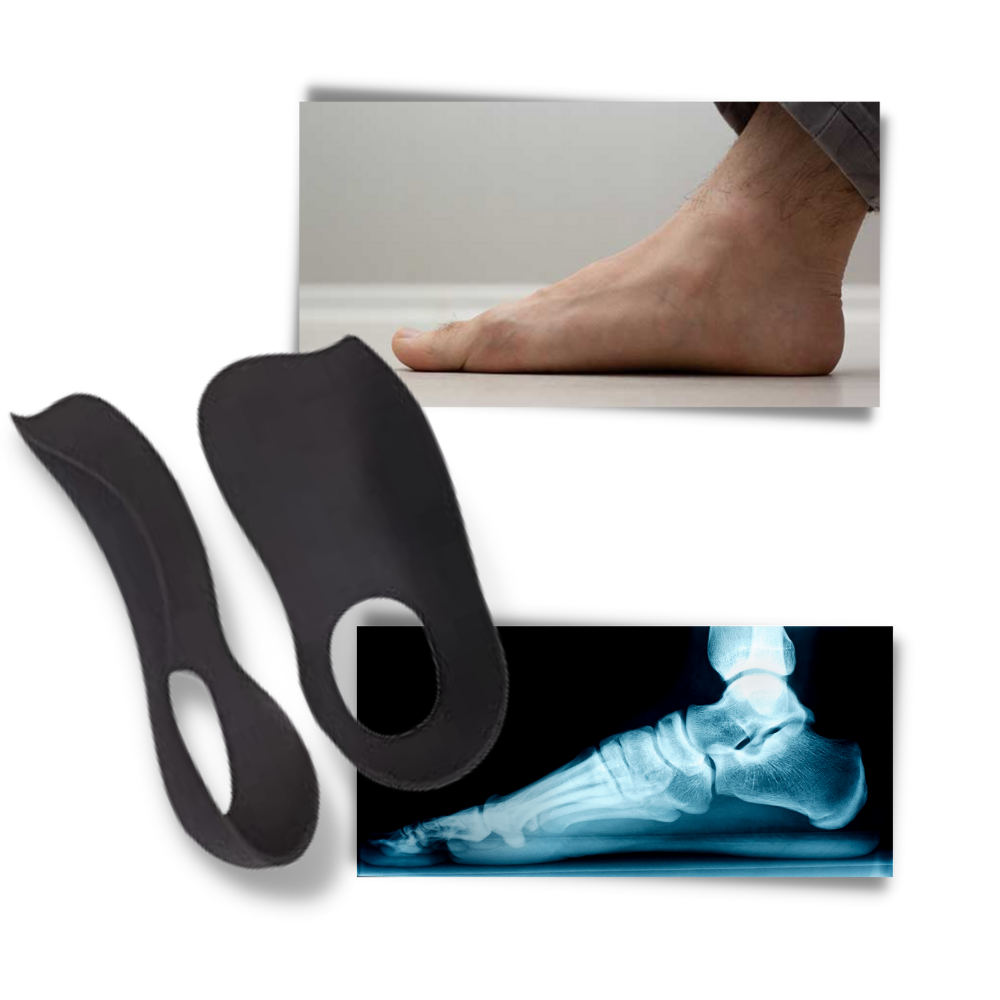Orthopädische Einlagen – Pelanva – Ansicht 3
