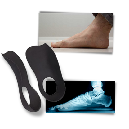 Orthopädische Einlagen – Pelanva – Ansicht 3