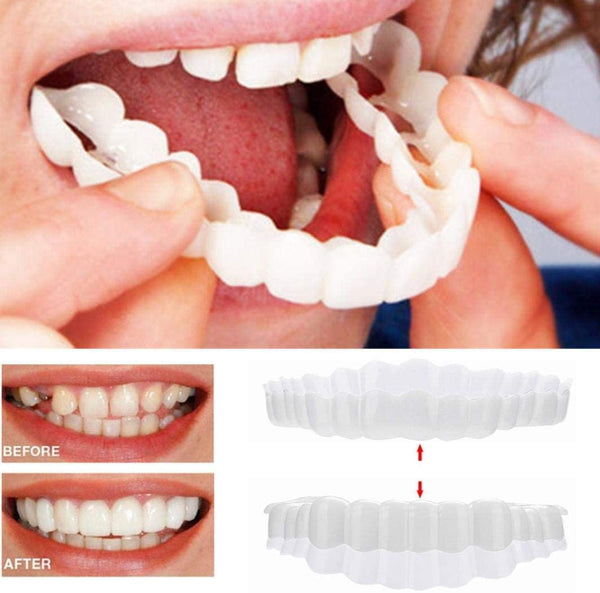 Zahnveneers – Pelanva – Ansicht 2